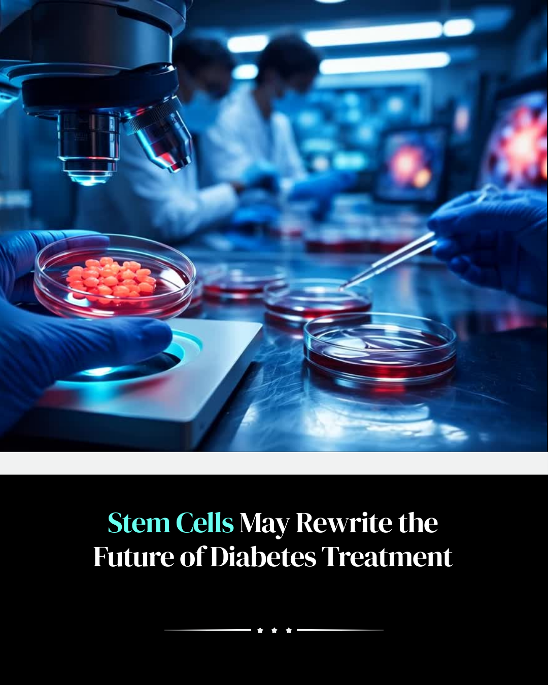 Stem cell therapy for diabetes treatment